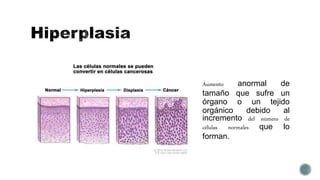 Aumento anormal de
tamaño que sufre un
órgano o un tejido
orgánico debido al
incremento del número de
células normales que lo
forman.
 