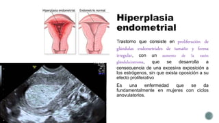 Trastorno que consiste en proliferación de
glándulas endometriales de tamaño y forma
irregular, con un aumento de la razón
glándula/estroma, que se desarrolla a
consecuencia de una excesiva exposición a
los estrógenos, sin que exista oposición a su
efecto proliferativo
Es una enfermedad que se da
fundamentalmente en mujeres con ciclos
anovulatorios.
 