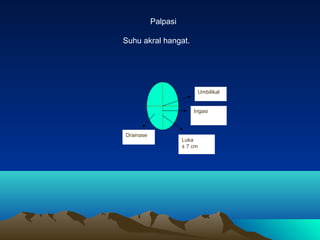 Palpasi
Suhu akral hangat.

Umbilikal
Irigasi

Drainase

Luka perasi
± 7 cm

 