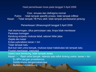 Hasil pemeriksaan torax pada tanggal 3 April 2006
Coor, sinuses dan diafragma normal
Pulmo : tidak tampak spesifik proses,...