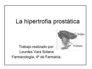 Hiperplasia prostatica