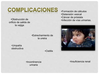 •Obstrucción de
orificio de salida de
la vejiga
•Insuficiencia renal
•Formación de cálculos
•Distensión vesical
•Cáncer de próstata
•Infección de vías urinarias.
•Cistitis
•Estrechamiento de
la uretra
•Incontinencia
urinaria
•Uropatía
obstructiva
 