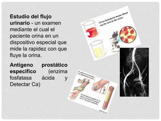 Estudio del flujo
urinario - un examen
mediante el cual el
paciente orina en un
dispositivo especial que
mide la rapidez con que
fluye la orina.
Antígeno prostático
especifico (enzima
fosfatasa ácida y
Detectar Ca)
 