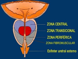 ZONA FIBROMUSCULAR
 