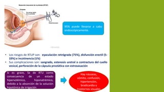 95% puede llevarse a cabo
endoscópicamente.
• Los riesgos de RTUP son: eyaculación retrógrada (75%), disfunción erectil (5-
10%) e incotinencia (1%)
• Sus complicaciones son: sangrado, estenosis uretral o contractura del cuello
vesical, perforación de la cápsula prostática con extravasación
Si es grave, Sx de RTU como
consecuencia de un estado
hipervolémico, hiponatrémico,
debido a la absorción de la solución
hipotónica de irrigación
Hay náuseas,
vómito, confusión,
hipertensión,
bradicardia y
trastornos visuales
 