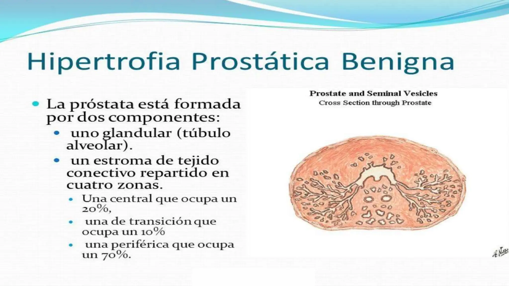 HIPERPLASIA PROSTATICA BENIGNA .pptx