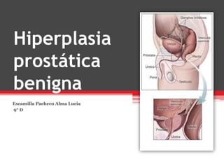 Hiperplasia
prostática
benigna
Escamilla Pacheco Alma Lucia
9° D
 