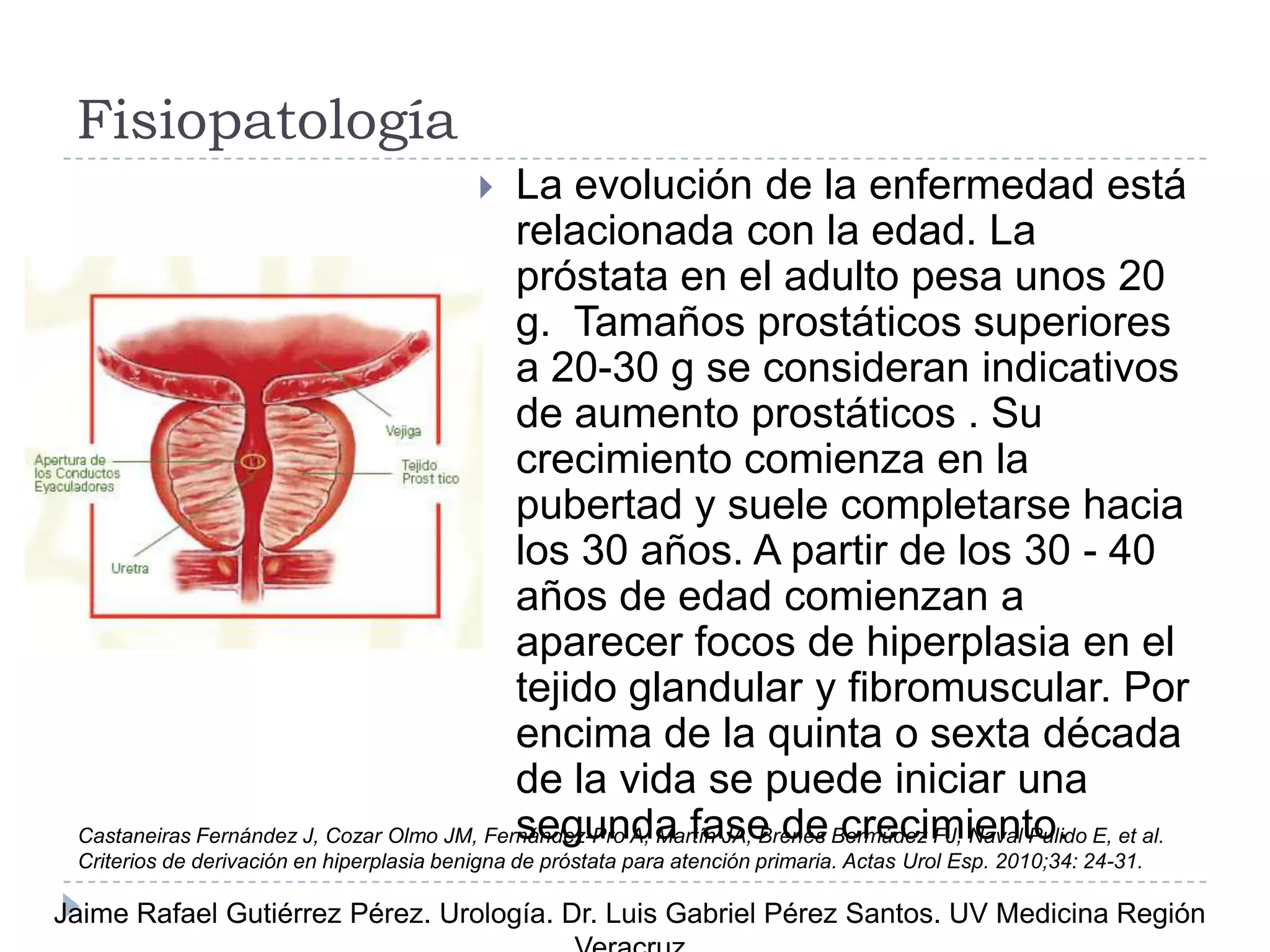 Hiperplasia prostática benigna | PPTX