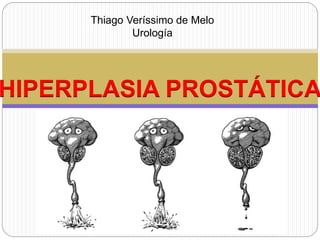 Thiago Veríssimo de Melo
Urología
HIPERPLASIA PROSTÁTICA
 