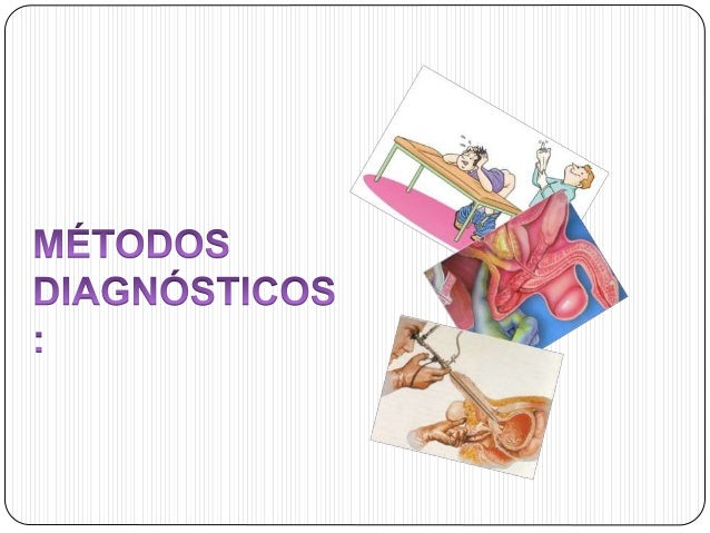 Hiperplasia prostática benigna Hiperplasia prostática benigna