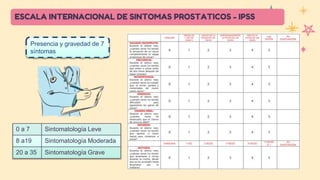 Hiperplasia Prostática Benigna.pptx