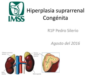 Hiperplasia suprarrenal
Congénita
R1P Pedro Silerio
Agosto del 2016
 