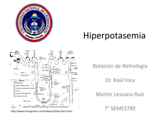 Hiperpotasemia
Rotación de Nefrología
Dr. Raúl Inca
Martin Lescano Ruiz
7° SEMESTREhttp://www.monografias.com/trabajos10/diur/diur.shtml
 