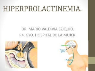 HIPERPROLACTINEMIA.
DR. MARIO VALDIVIA EZIQUIO.
R4. GYO. HOSPITAL DE LA MUJER.
 
