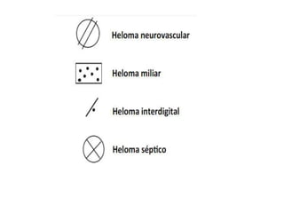 HIPERQUERATOSIS 1.pptx