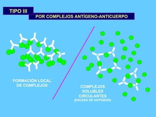 POR COMPLEJOS ANTÍGENO-ANTICUERPO TIPO III FORMACIÓN LOCAL DE COMPLEJOS COMPLEJOS SOLUBLES CIRCULANTES (EXCESO DE ANTÍGENO) 