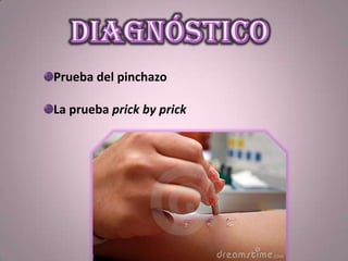 Prueba del pinchazo
La prueba prick by prick
 