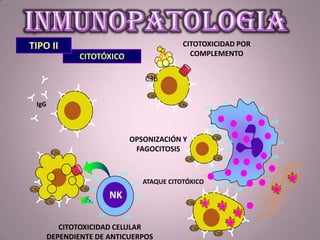 CITOTÓXICO
C3b
C3b
C3b
CITOTOXICIDAD POR
COMPLEMENTO
FcR
FcR
FcR
CR
CR
C3b
C3bC3b
C3b
C3b
C3b
FcR
CR
FcR
CR
FcR
CR
FcR
CR
FcR
CR
FcR
FcR
OPSONIZACIÓN Y
FAGOCITOSIS
ATAQUE CITOTÓXICO
FcR
FcR
CR
CR
FcR
CR
NK
FasL
FasL
C3b
C3bC3b
C3b
Fas
CITOTOXICIDAD CELULAR
DEPENDIENTE DE ANTICUERPOS
TIPO II
IgG
 