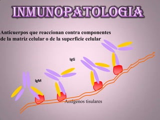 Antígenos tisulares
Anticuerpos que reaccionan contra componentes
de la matriz celular o de la superficie celular
IgM
IgG
 
