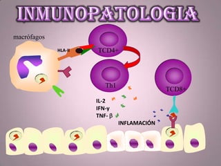 TCD8+
macrófagos
TCD4+
Th1
HLA-II
IL-2
IFN-y
TNF-
INFLAMACIÓN
 