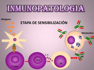 Mastocitos
Alergeno
LT CD4+
Th2
LB
T CD4+
IgE
ETAPA DE SENSIBILIZACIÓN
IL-4
FC
FC
TCR
 