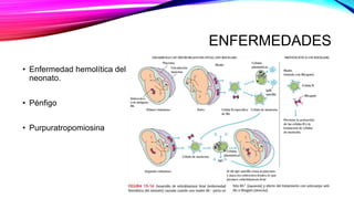 ENFERMEDADES
• Enfermedad hemolítica del
neonato.
• Pénfigo
• Purpuratropomiosina
 