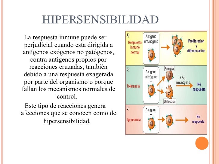 hipersensibilidad tipò IV y tuberculosis
