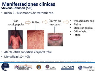 Hipersensibilidad a anticonvulsivantes | PDF