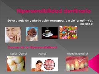Causas de la Hipersensibilidad
Caries Dental

Fisuras

Recesión gingival

 
