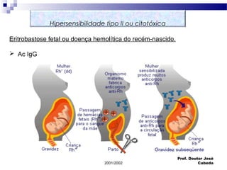 2001/2002
Prof. Doutor José
Cabeda
Eritrobastose fetal ou doença hemolítica do recém-nascido.
 Ac IgG
Hipersensibilidade tipo II ou citotóxica
 