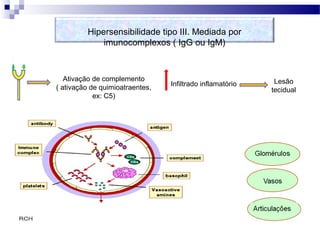 Infiltrado inflamatório Lesão
tecidual
Ativação de complemento
( ativação de quimioatraentes,
ex: C5)
Hipersensibilidade tipo III. Mediada por
imunocomplexos ( IgG ou IgM)
 