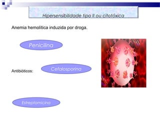Anemia hemolítica induzida por droga.
Antibióticos:
Hipersensibilidade tipo II ou citotóxica
Penicilina
Cefalosporina
Estreptomicina
 