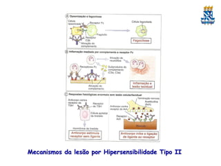 Mecanismos da lesão por Hipersensibilidade Tipo II

 