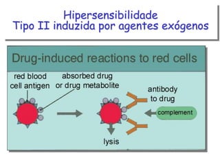 Hipersensibilidade
Tipo II induzida por agentes exógenos

 