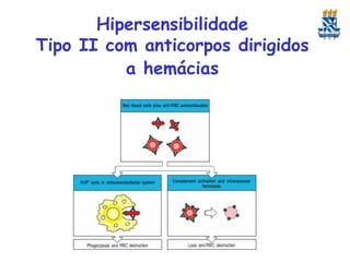 Hipersensibilidade
Tipo II com anticorpos dirigidos
a hemácias

 