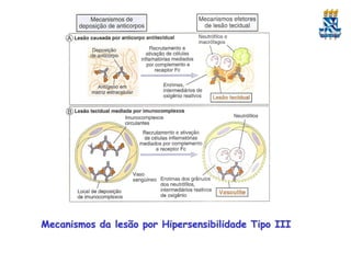 Mecanismos da lesão por Hipersensibilidade Tipo III

 