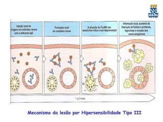 Mecanismo da lesão por Hipersensibilidade Tipo III

 