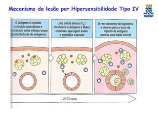 Mecanismo da lesão por Hipersensibilidade Tipo IV

 