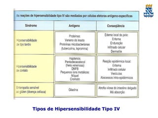 Tipos de Hipersensibilidade Tipo IV

 
