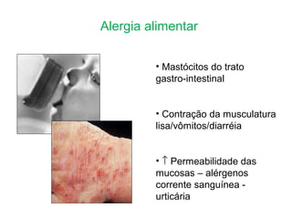 Alergia alimentar
• Mastócitos do trato
gastro-intestinal
• Contração da musculatura
lisa/vômitos/diarréia
• ↑ Permeabilidade das
mucosas – alérgenos
corrente sanguínea -
urticária
 