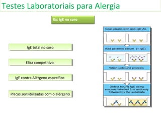 Testes Laboratoriais para Alergia
Ex: IgE no soro
IgE total no soroIgE total no soro
Elisa competitivoElisa competitivo
IgE contra Alérgeno específicoIgE contra Alérgeno específico
Placas sensibilizadas com o alérgenoPlacas sensibilizadas com o alérgeno
 