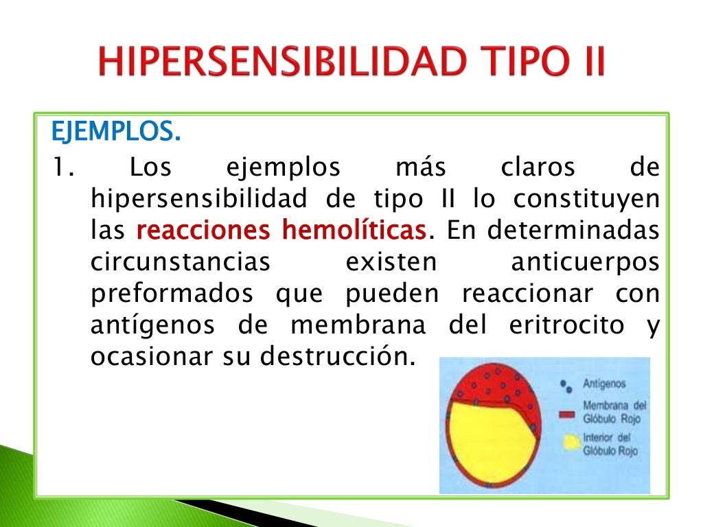 Hipersensibilidad tipo ii