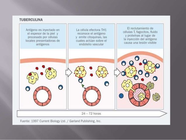 Hipersensibilidad tipo iv o tardia