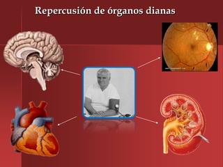 Repercusión de órganos dianas
 