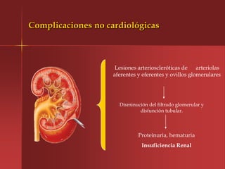 Complicaciones no cardiológicas



                     Lesiones arterioscleróticas de arteriolas
                    aferentes y eferentes y ovillos glomerulares




                      Disminución del filtrado glomerular y
                              disfunción tubular.



                              Proteinuria, hematuria
                               Insuficiencia Renal
 