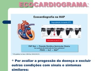  Por avaliar a progessão da doença e excluir
outras condições com sinais e sintomas
similares;
 