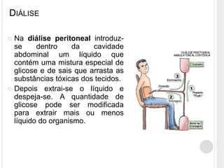 DIÁLISE

 Na diálise peritoneal introduz-
  se     dentro     da   cavidade
  abdominal um líquido que
  contém uma mistura especial de
  glicose e de sais que arrasta as
  substâncias tóxicas dos tecidos.
 Depois extrai-se o líquido e
  despeja-se. A quantidade de
  glicose pode ser modificada
  para extrair mais ou menos
  líquido do organismo.
 