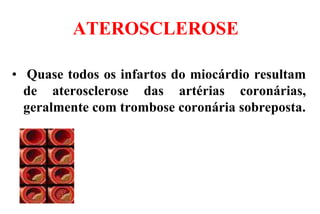 ATEROSCLEROSE
• Quase todos os infartos do miocárdio resultam
de aterosclerose das artérias coronárias,
geralmente com trombose coronária sobreposta.
 