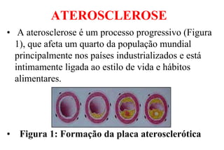 ATEROSCLEROSE
• A aterosclerose é um processo progressivo (Figura
1), que afeta um quarto da população mundial
principalmente nos países industrializados e está
intimamente ligada ao estilo de vida e hábitos
alimentares.
• Figura 1: Formação da placa aterosclerótica
 