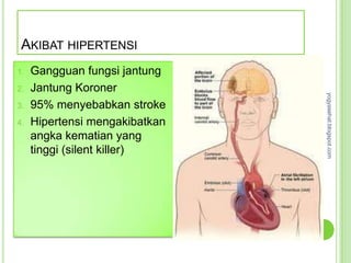 AKIBAT HIPERTENSI
1.   Gangguan fungsi jantung
2.   Jantung Koroner




                                yogyasehat.blogspot.com
3.   95% menyebabkan stroke
4.   Hipertensi mengakibatkan
     angka kematian yang
     tinggi (silent killer)
 